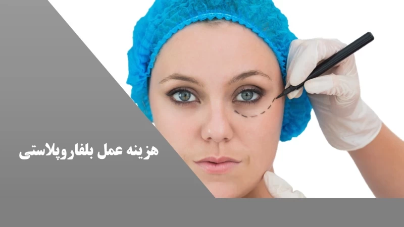 هزینه عمل بلفاروپلاستی