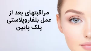 مراقبتهای بعد از عمل بلفاروپلاستی پلک پایین | ۴ نکته کلیدی