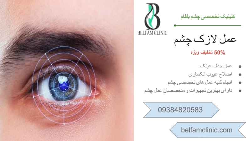 عمل لازک