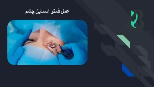 عمل فمتو اسمایل