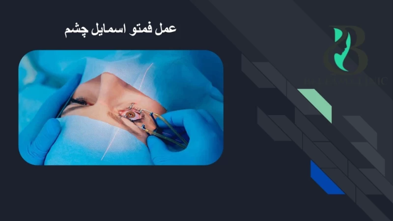 عمل فمتو اسمایل
