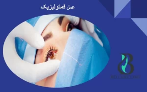 عمل فمتولیزیک