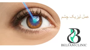 عمل لازیک