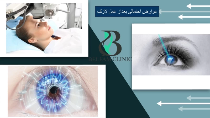 عوارض احتمالی بعداز عمل لازک