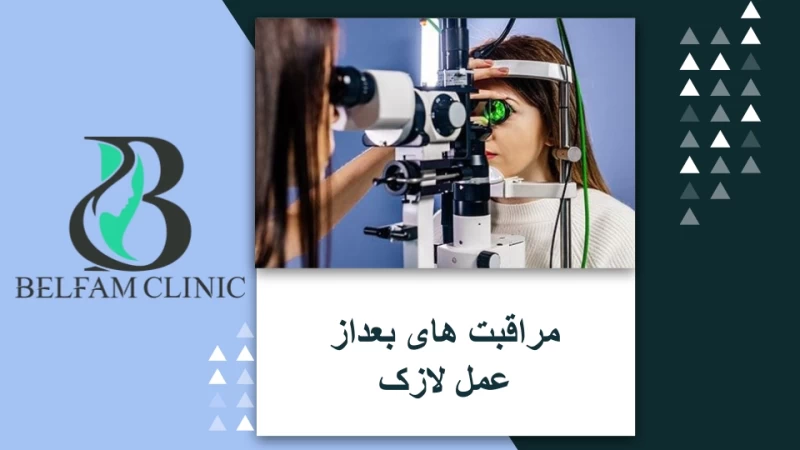 روش های عمل لازک