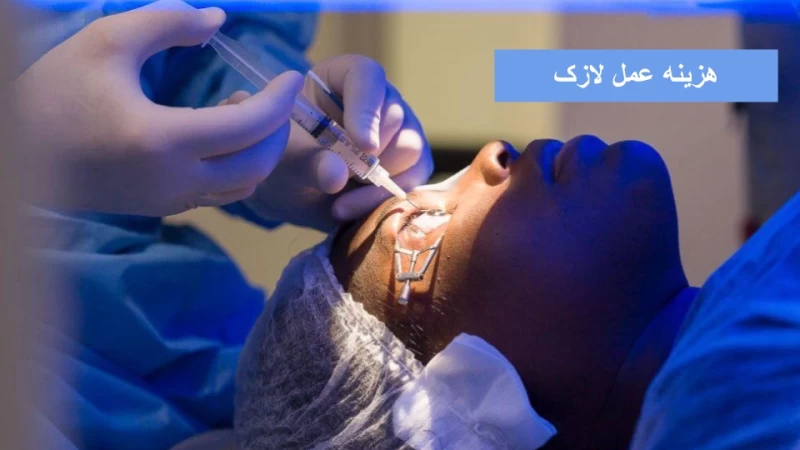 هزینه عمل لازک